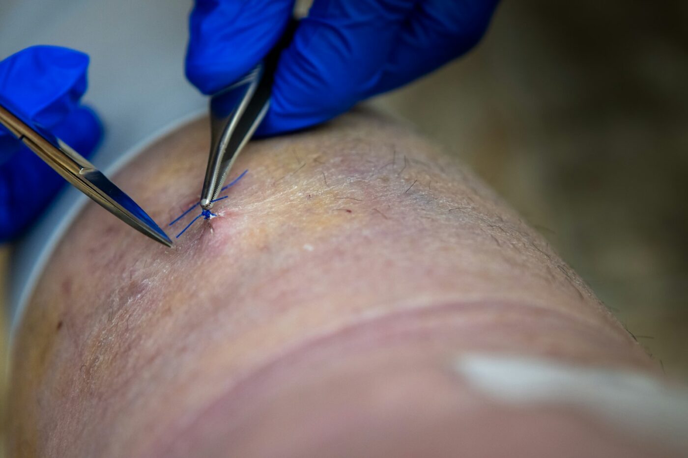 Wijkverpleegkundige verzorgt een wond aan het onderbeen van een cliënt in een behandelruimte