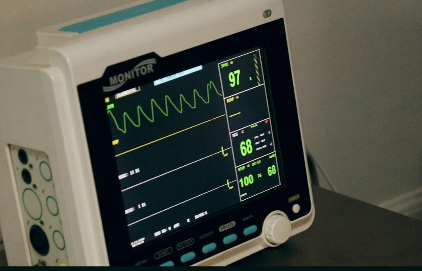 ECG-apparaat met elektroden klaar voor gebruik in een behandelkamer